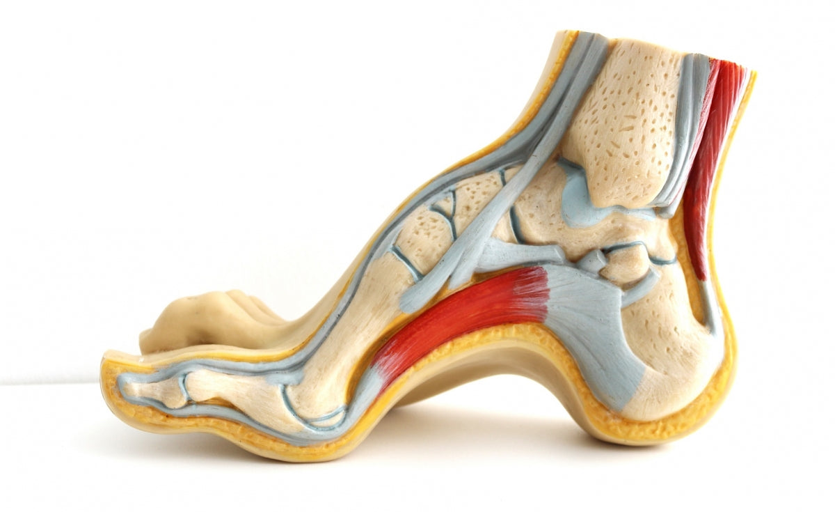 Cavovarus Foot