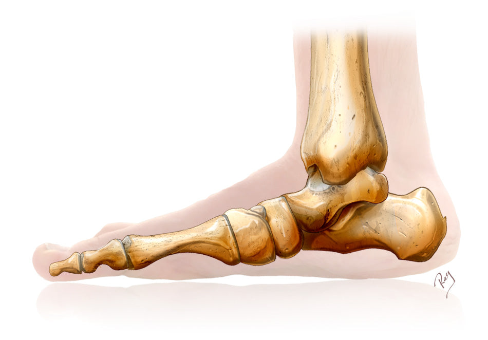 Flat Foot